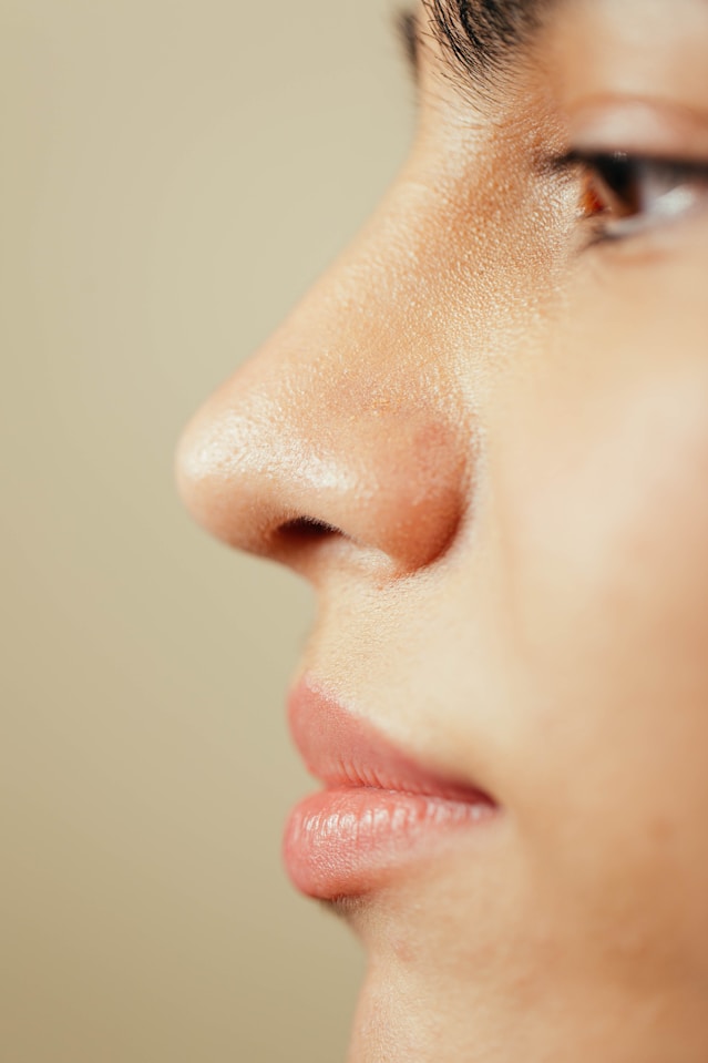 Rinoplastia